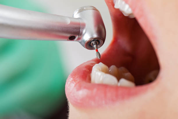 Best Emergency Cosmetic Dentistry in Chain Lake, WA